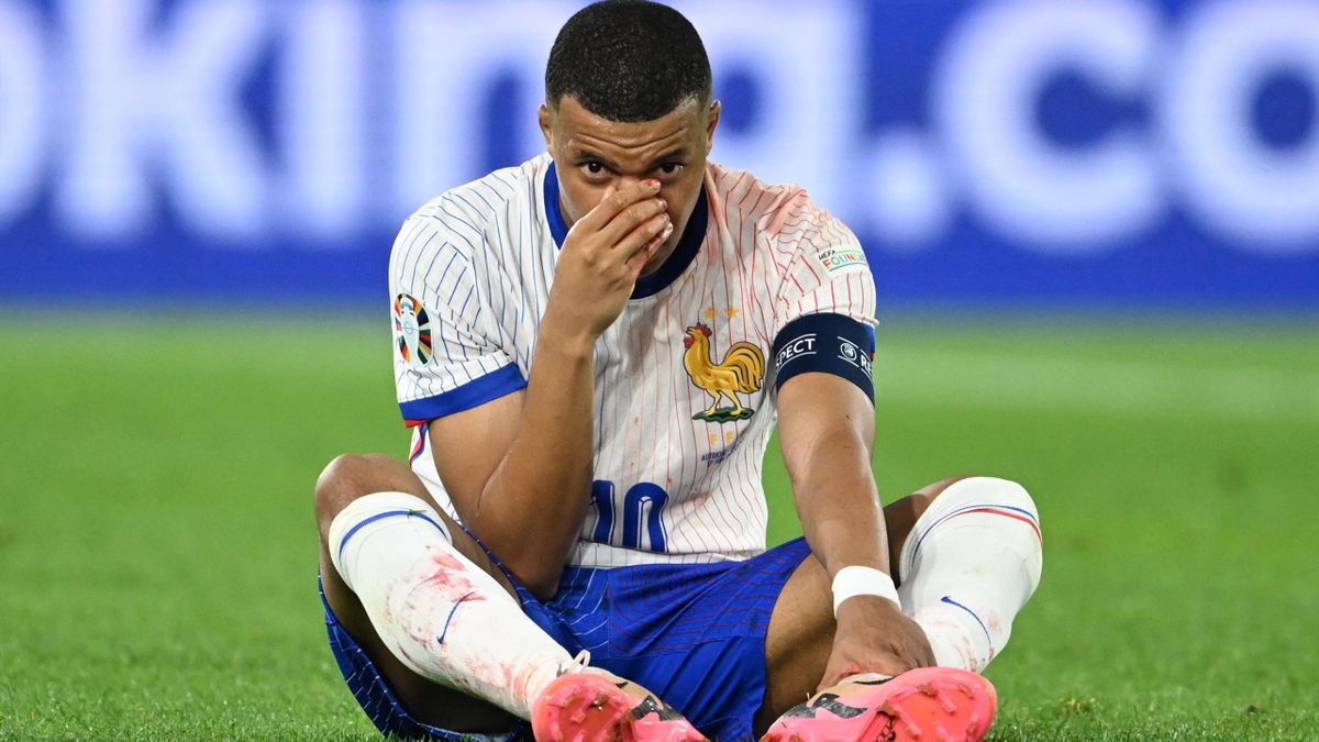 Mbappe gãy mũi, sẽ đeo mặt nạ hết EURO 2024 - Ảnh 1