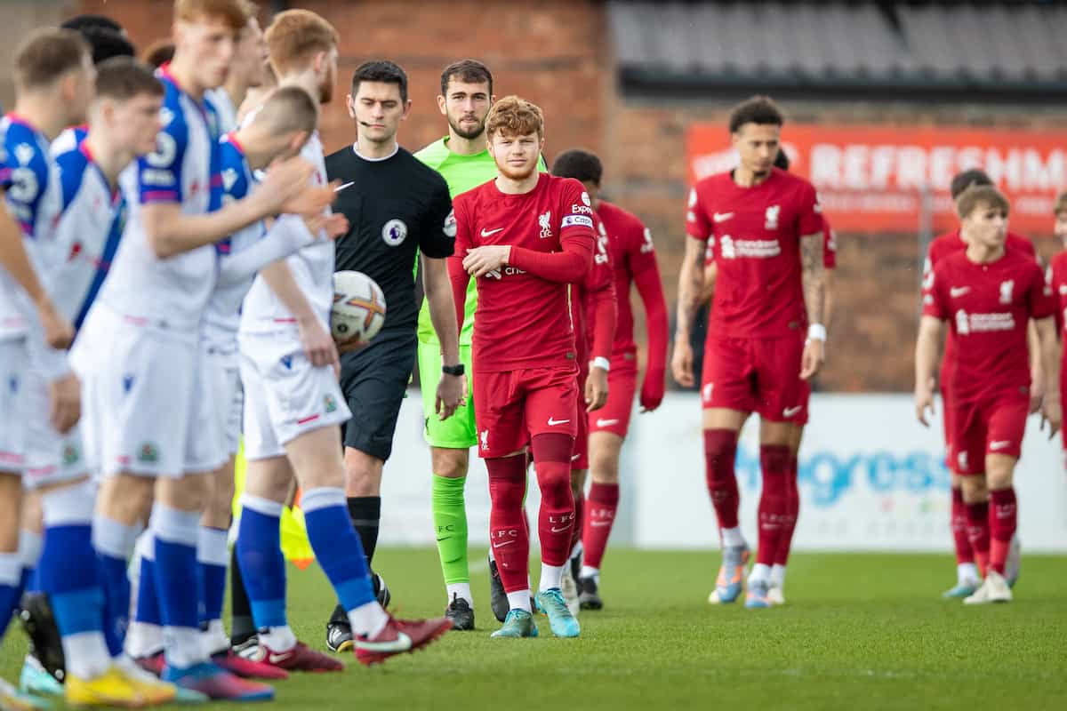 Nhận định, Soi kèo U21 Liverpool vs U21 Burnley, 20h00 ngày 25/8: Cửa dưới ngoi lên - Ảnh 3
