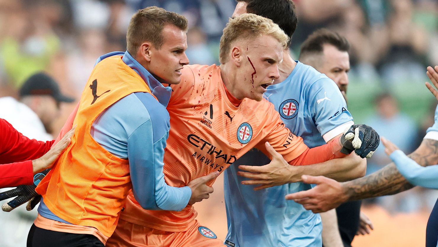 Nhận định, Soi kèo Melbourne City vs Melbourne Victory, 15h35 ngày 21/2: Kịch bản lặp lại - Ảnh 4