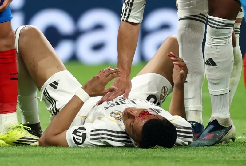 Mbappe phải khâu 3 mũi trước màn tái đấu Bayern Munich - Ảnh 1